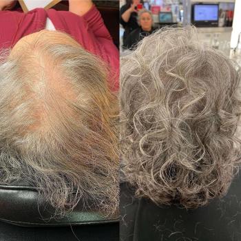 Image for Scalp Headquarters LLC with ID of: 6046084