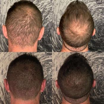 Image for Scalp Headquarters LLC with ID of: 6046085
