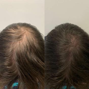 Image for Scalp Headquarters LLC with ID of: 6046086