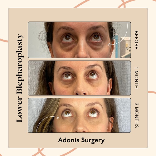 Image for Adonis Plastic Surgery with ID of: 6055076
