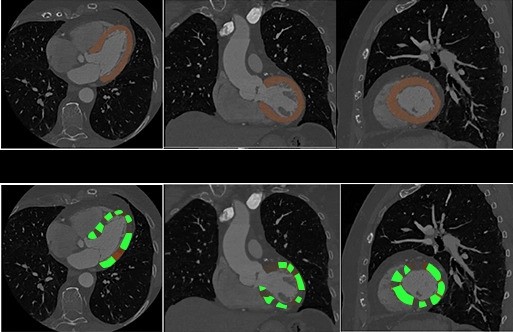 Image for Cardiovascular Image Annotation & Cardiac Data Labeling with ID of: 6649517