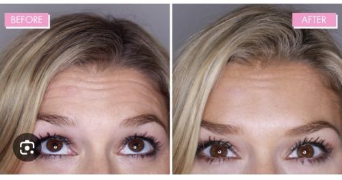 Image for Temecula Skin Deep with ID of: 6086179