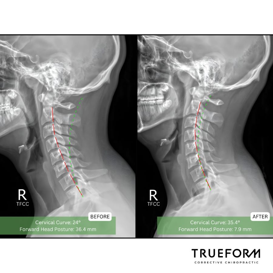Image for TrueForm Corrective Chiropractic with ID of: 6130735