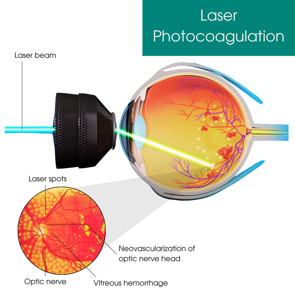 Image for Eye Physicians with ID of: 6138087