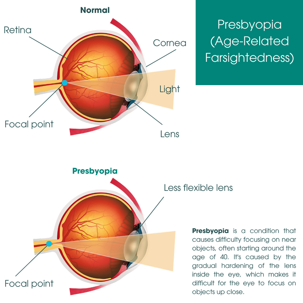 Image for Eye Physicians with ID of: 6138088
