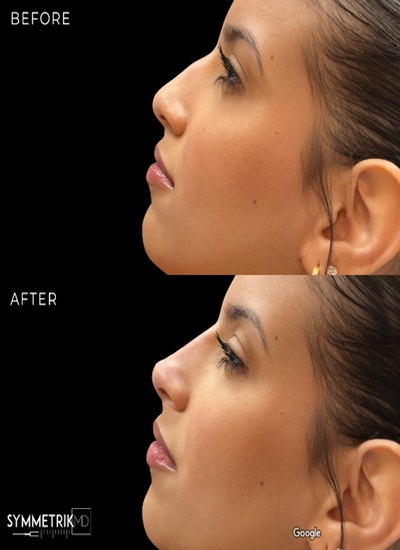 Image for Symmetrik MD with ID of: 6177284