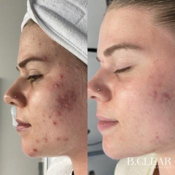 Image for B. Clear Aesthetics with ID of: 6196634