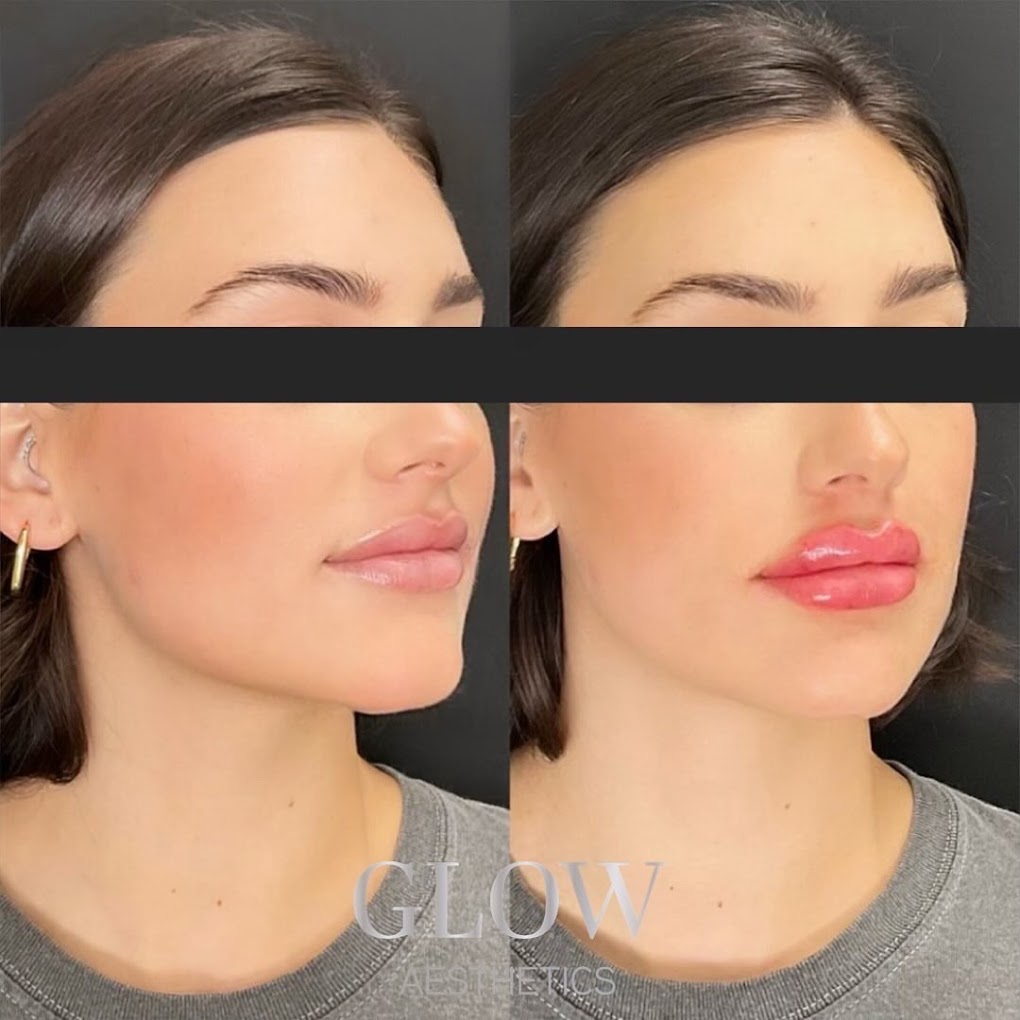 Image for Glow Aesthetics Bar with ID of: 6239912