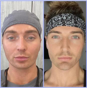 Image for Randy Lindgren Aesthetic Rejuvenation with ID of: 6263842