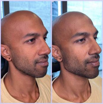 Image for Randy Lindgren Aesthetic Rejuvenation with ID of: 6263843