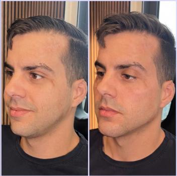 Image for Randy Lindgren Aesthetic Rejuvenation with ID of: 6263844