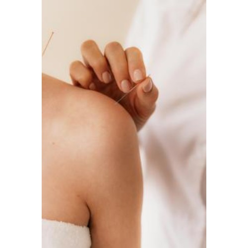Image for Wild Acupuncture with ID of: 6744882