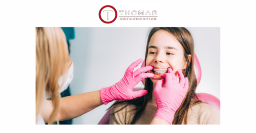 Image for Thomas Orthodontics with ID of: 6317473