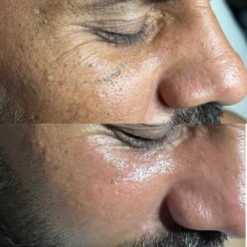 Image for Alluria Laser & Med Spa with ID of: 6362594