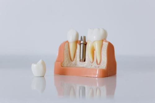 Image for Dental Local with ID of: 6392389