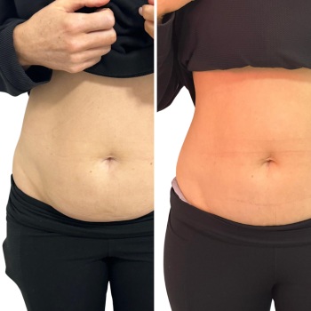 Image for Bodi Beauty with ID of: 6392728