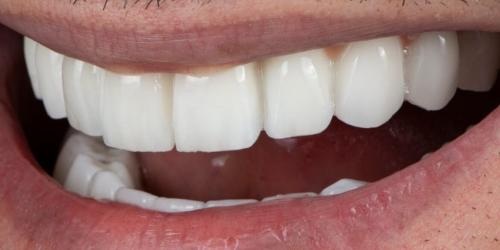 Image for Schaefer Dental Group with ID of: 6394726