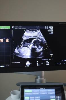Image for Prestige Prenatal Imaging with ID of: 6395926