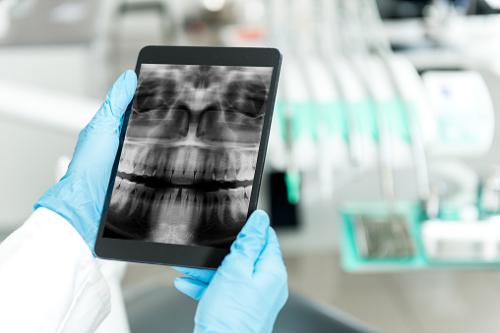 Image for YJ OMS Dental Implants & Oral Surgery with ID of: 6397022