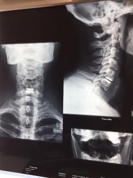 Image for Hunter Spine and Joint Replacement Centre with ID of: 6398222