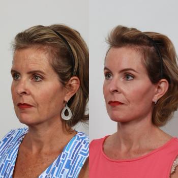 Image for Locketz Facial Plastic Surgery with ID of: 6429055