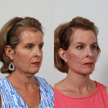 Image for Locketz Facial Plastic Surgery with ID of: 6429066