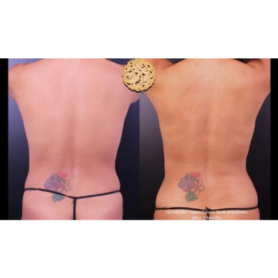 Image for Nazarian Plastic Surgery with ID of: 6441043