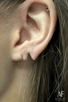 Image for About Face MD with ID of: 6457090