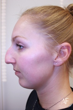 Image for About Face MD with ID of: 6457093