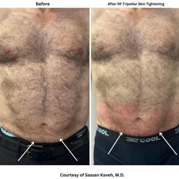 Image for Alpha Medical Aesthetics with ID of: 6470886