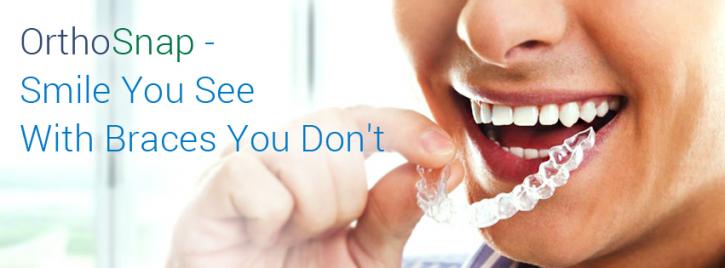 Image for How To Straighten Teeth Without Braces with ID of: 681698