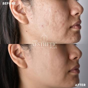 Image for The Aesthetic Plan with ID of: 6526308