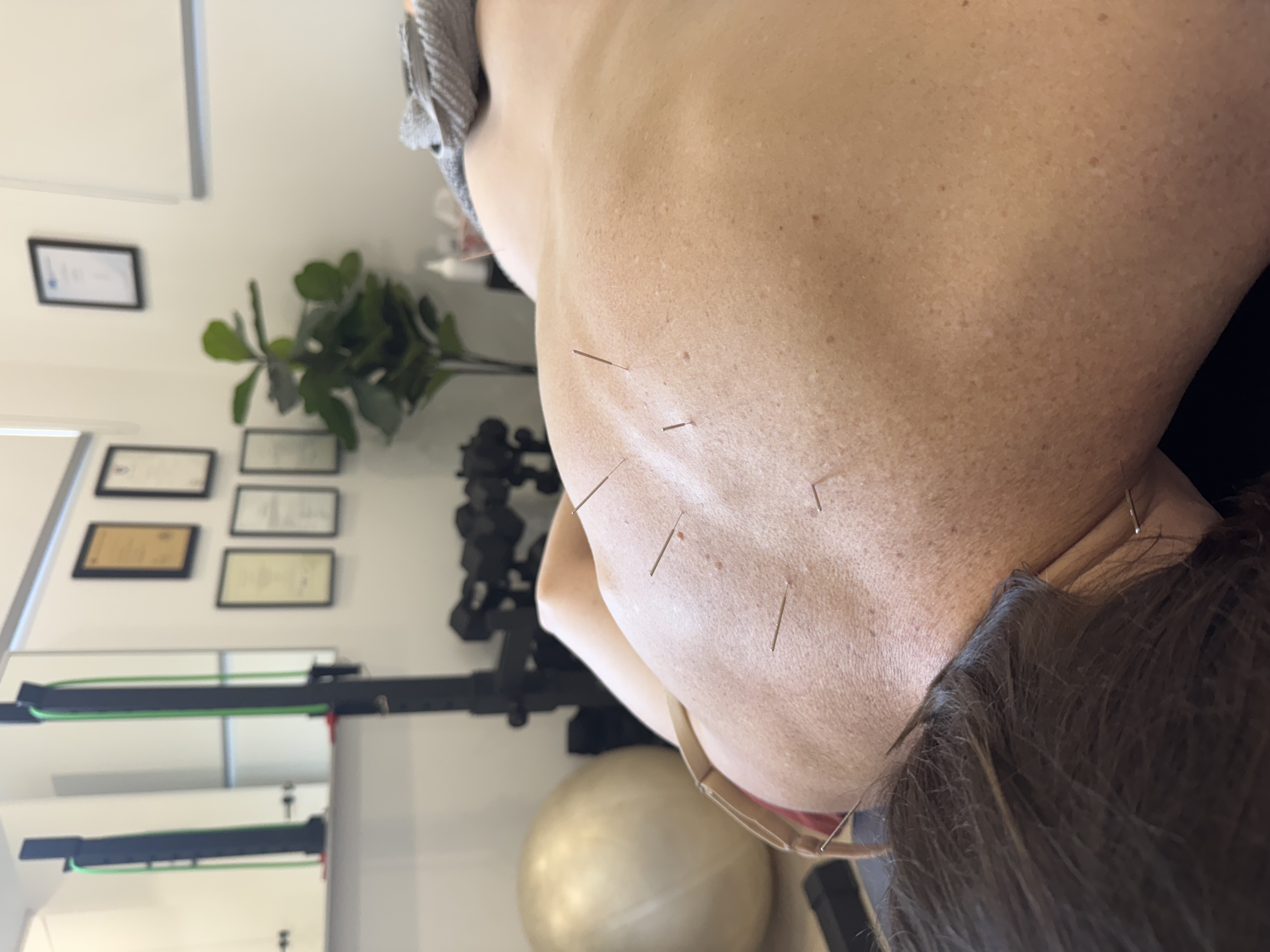Image for PACT Physio & Rehab with ID of: 6535913