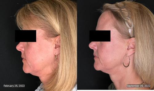 Image for Ageless Expressions | Golden CO with ID of: 6572779