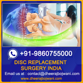 Image for Cervical Disc Replacement Surgery in India with ID of: 6874486