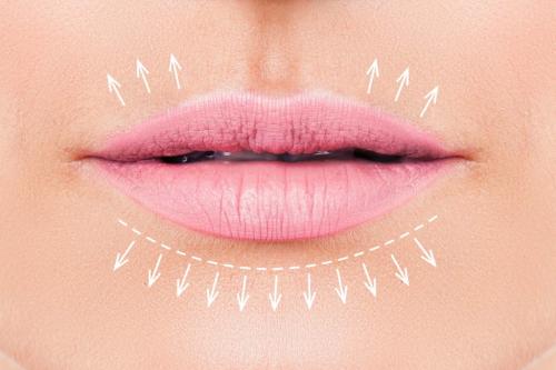 Image for Dermatouch - Botox Fillers, Micro Needling, PRP with ID of: 6630733