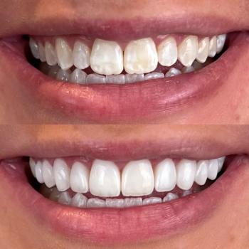 Image for Downtown Phoenix Dental with ID of: 6646858