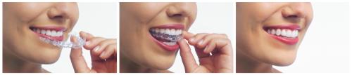 Image for Fallowfield Dental with ID of: 6648369