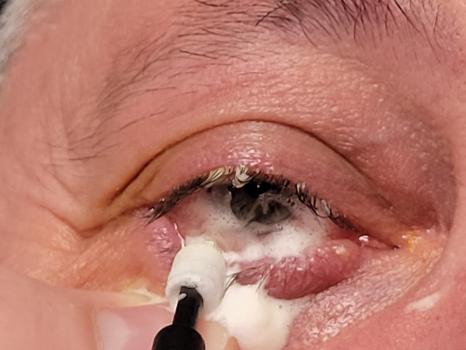 Image for Lake Lanier Eye Care with ID of: 6655335