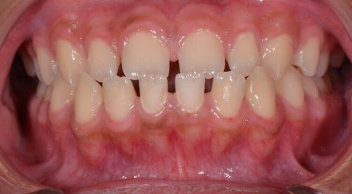 Image for Schimmel Orthodontic Associates with ID of: 6668633