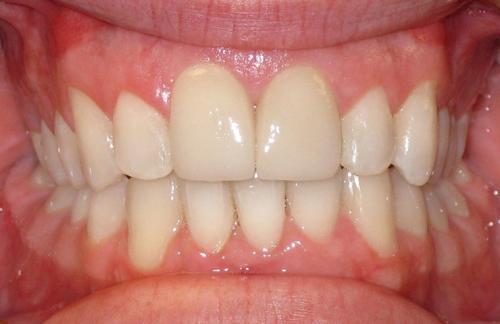 Image for Schimmel Orthodontic Associates with ID of: 6668634