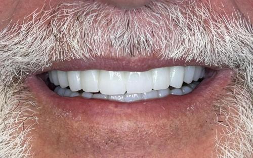 Image for Cornerstone Dentistry with ID of: 6670557