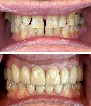 Image for Cornerstone Dentistry with ID of: 6670559