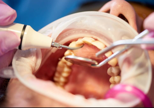 Image for Dentistry at Frederick with ID of: 6675509
