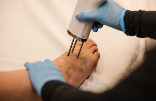 Image for Premier Body and Laser with ID of: 6701102