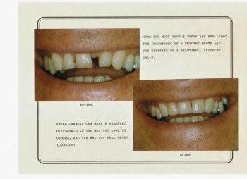 Image for Signature Smiles Dental Group with ID of: 6704650