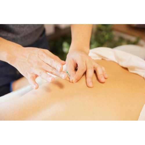 Image for Wild Acupuncture with ID of: 6744885