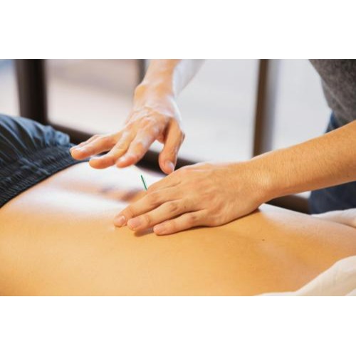 Image for Wild Acupuncture with ID of: 6744886