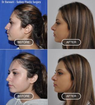 Image for Sydney Plastic Surgery with ID of: 6746440