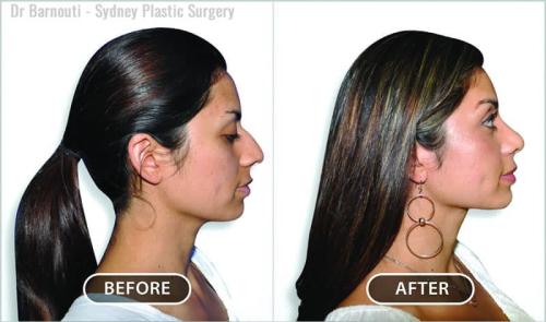 Image for Sydney Plastic Surgery with ID of: 6746441